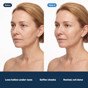Before and week 6 with Deep Collagen